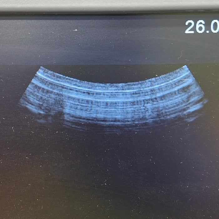 Siemens 4C1 Curved Transducer