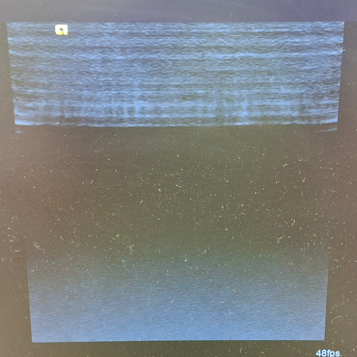 Siemens Acuson 9L4 Linear Transducer