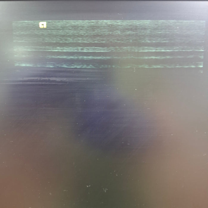 Siemens Acuson S1000 Ultrasound