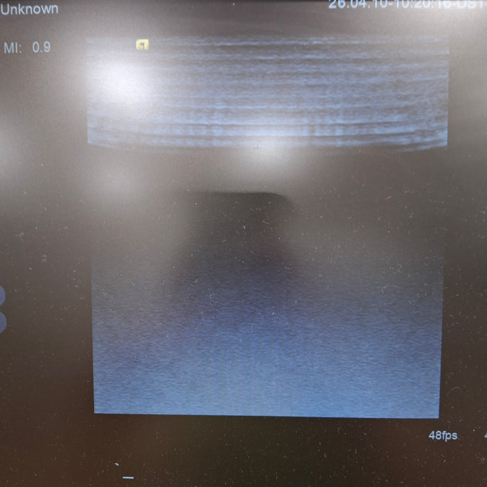 Siemens Acuson S1000 Ultrasound