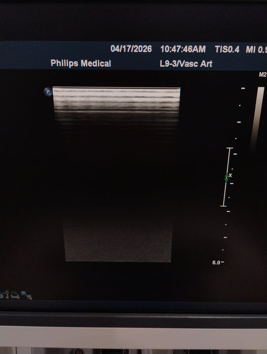 Philips L9-3 Linear Array Transducer