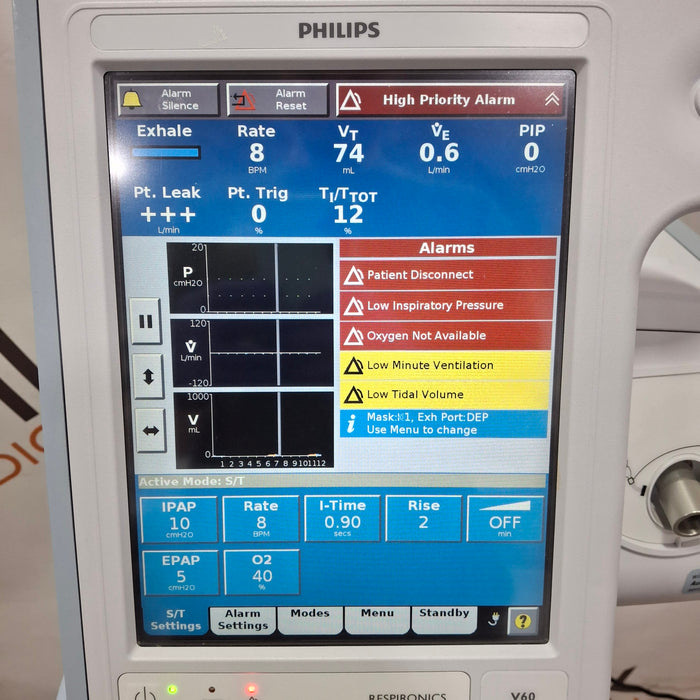 Philips Respironics V60 BiPAP Ventilator