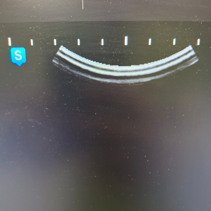Samsung H60 Ultrasound System