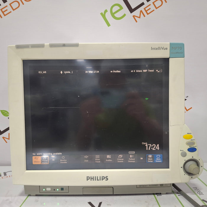 Philips IntelliVue MP70 - Anesthesia Patient Monitor