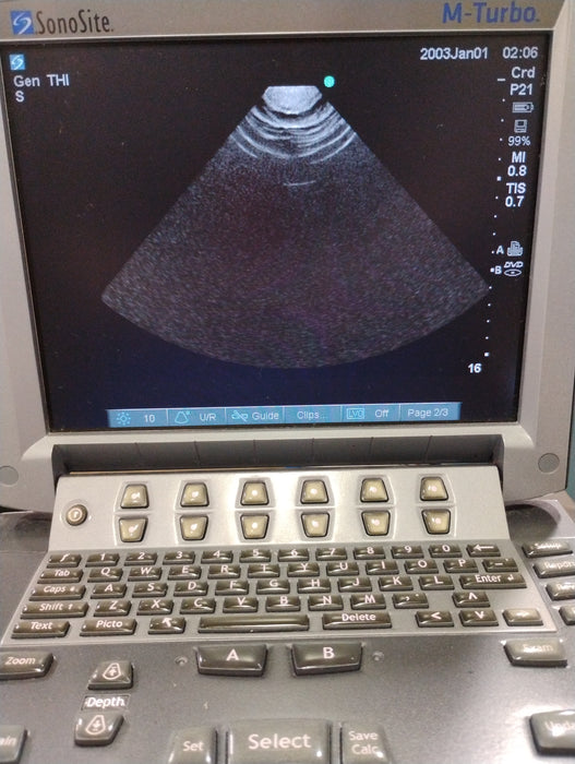 Sonosite M-Turbo Ultrasound