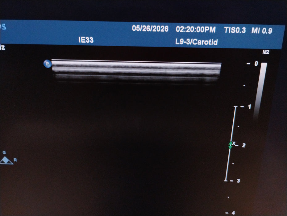 Philips L9-3 Linear Array Transducer