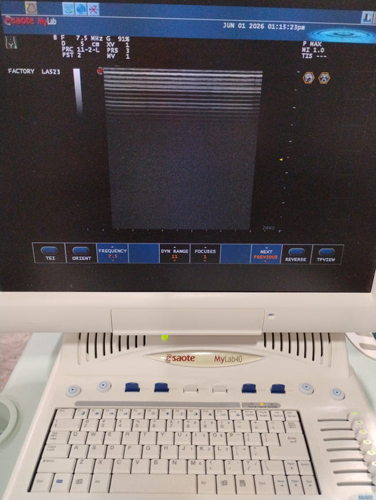 Esaote BioSound MyLab 40 Ultrasound