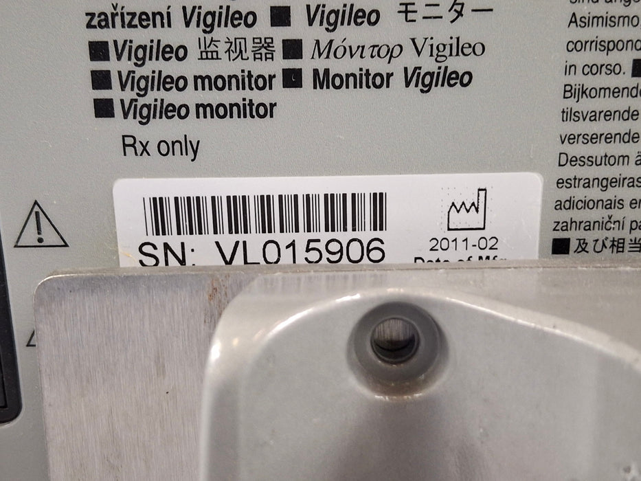 Edwards Lifesciences Vigileo Patient Monitor