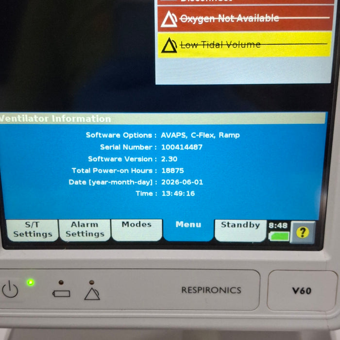 Philips Respironics V60 BiPAP Ventilator