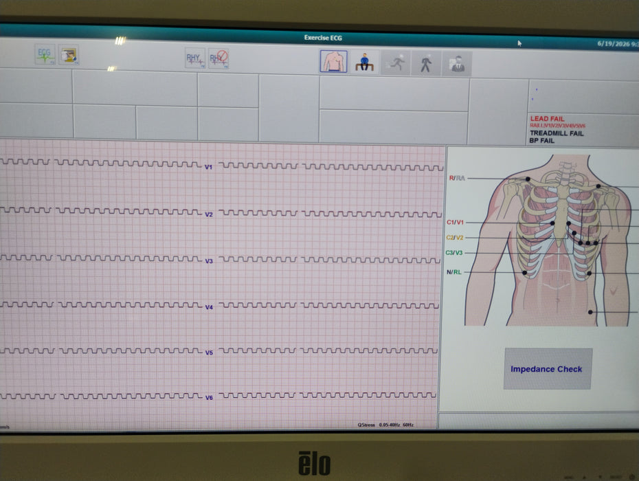 Mortara Quinton Q Stress System Console