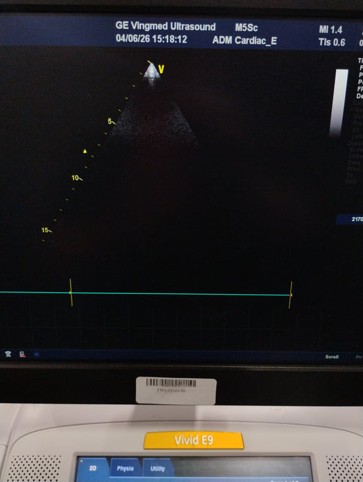 GE Healthcare Vivid E9 Ultrasound