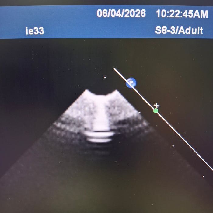 Philips IE33 F-G Cart Ultrasound