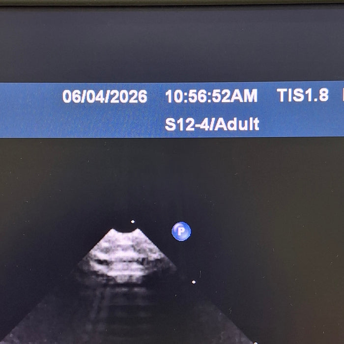Philips S12-4 Sector Array Transducer