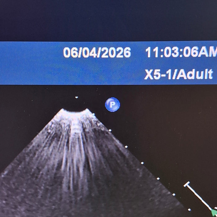 Philips X5-1 Matrix Array Transducer