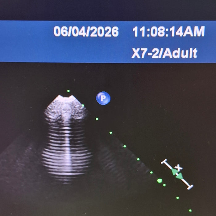 Philips X7-2 xMATRIX Array Transducer