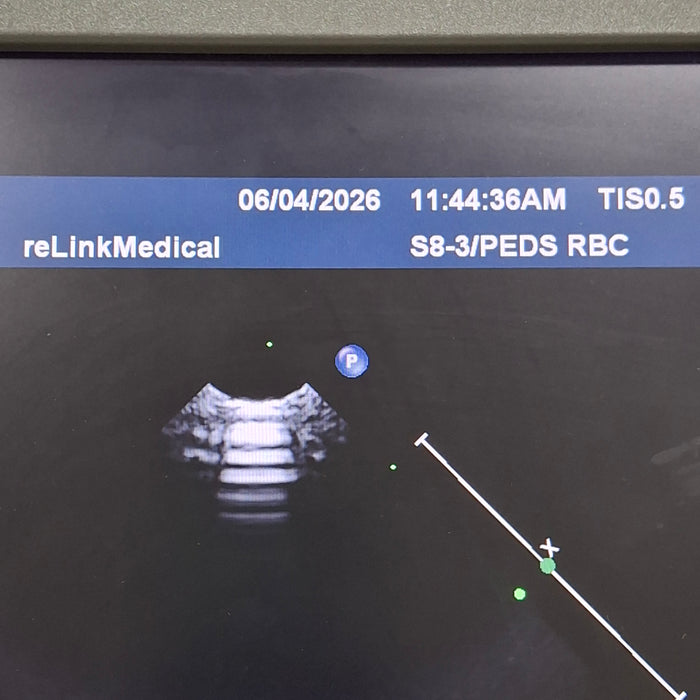 Philips IE33 F-G Cart Ultrasound