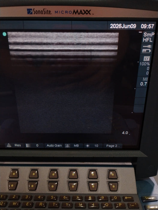 Sonosite Micromaxx Portable Ultrasound