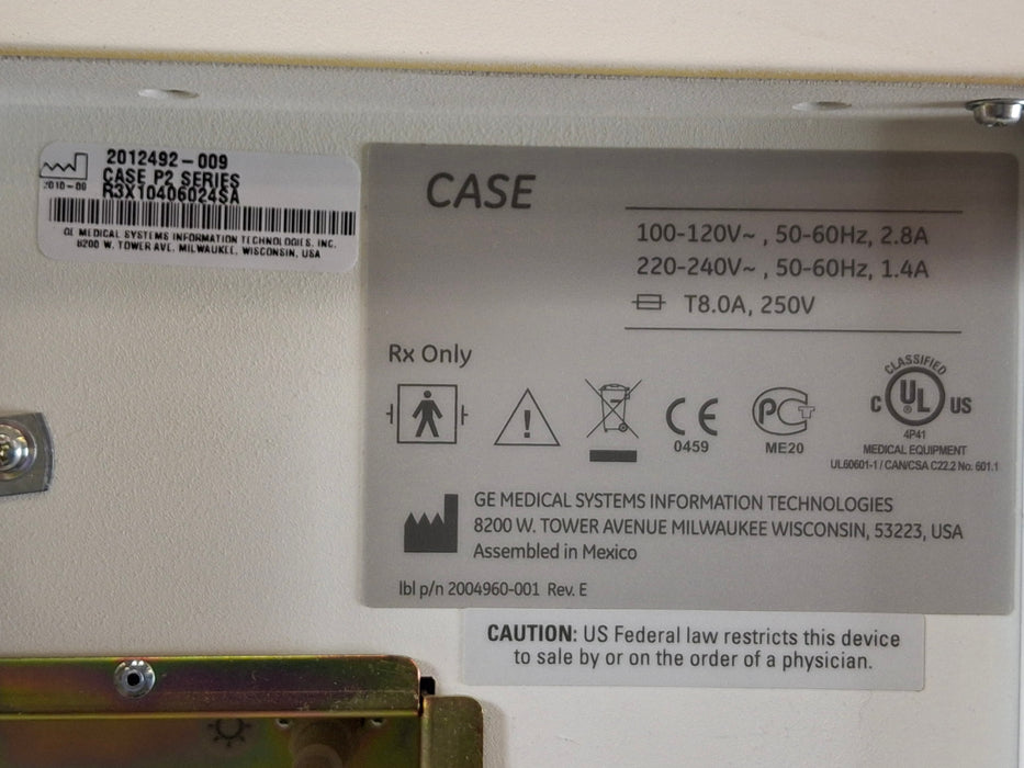 GE Healthcare Case P2 Stress Test Console