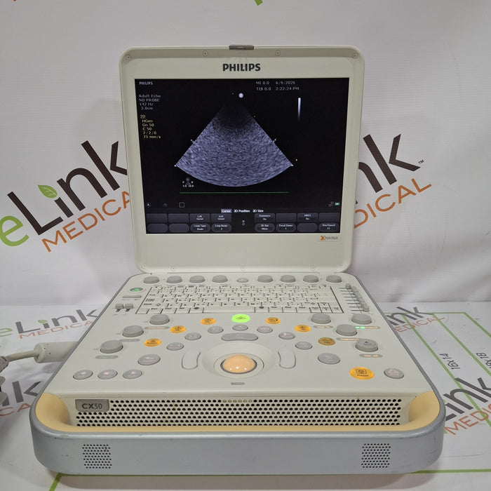 Philips CX50 Ultrasound