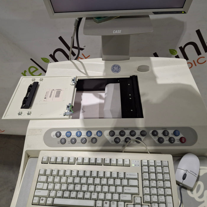 GE Healthcare Case P2 Stress Test Console