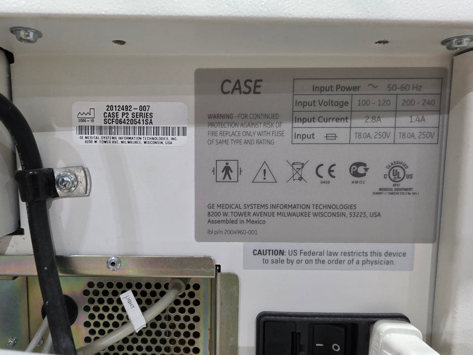 GE Healthcare Case P2 Stress Test Console