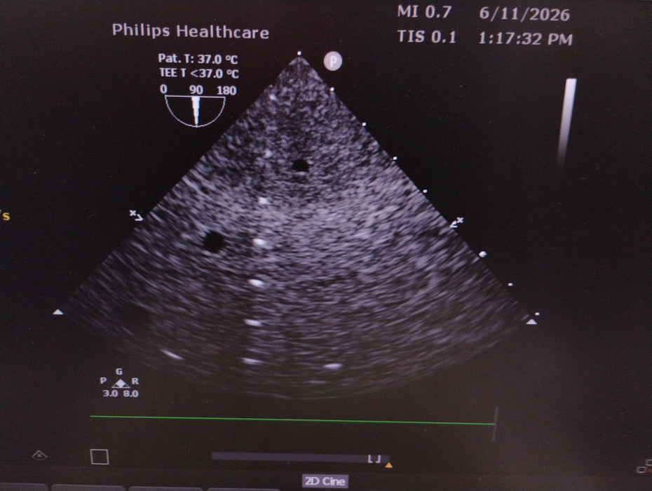 Philips X8-2t TEE Probe Transducer