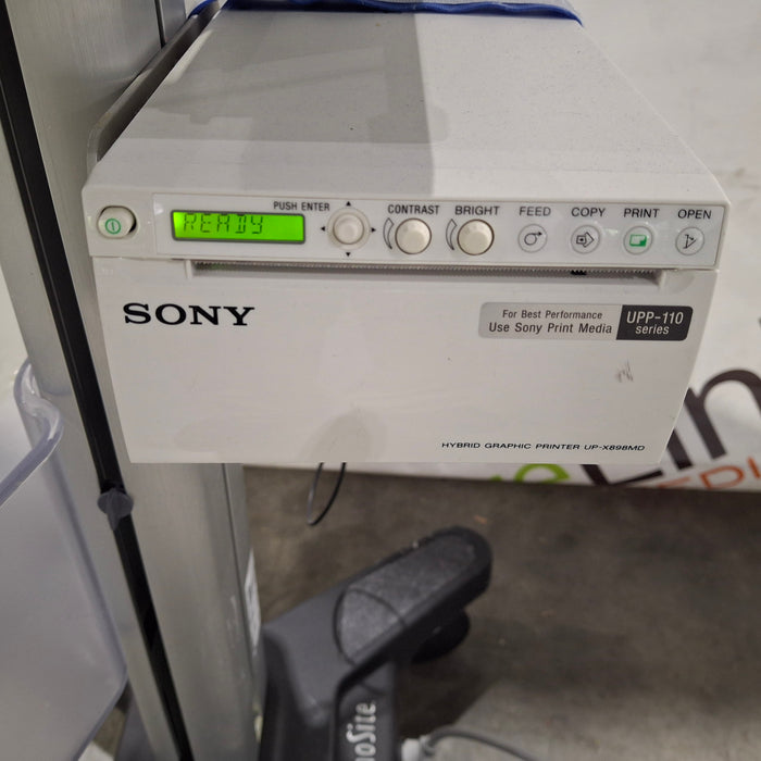 Sonosite S-Cath Ultrasound