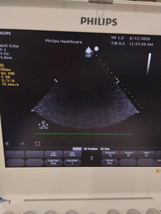 Philips S5-1 Epiq Sector Array Transducer