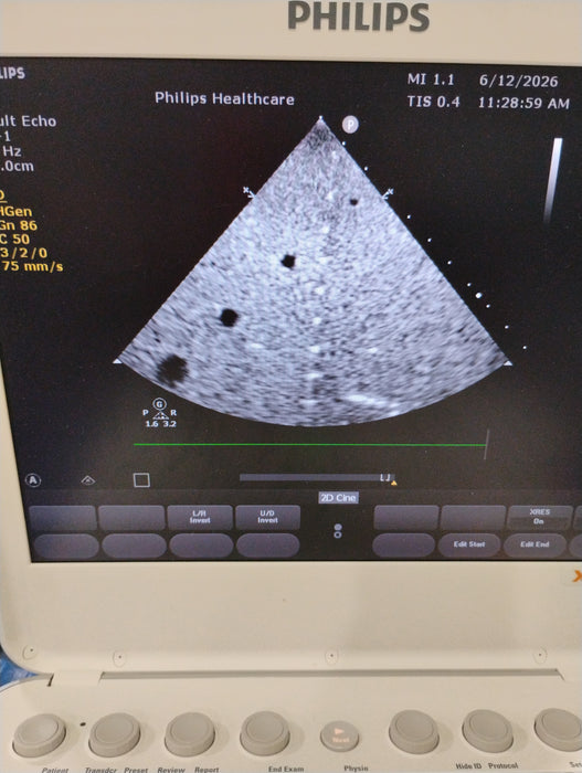 Philips S5-1 Epiq Sector Array Transducer