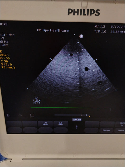 Philips S8-3 EPIQ Cardiac Array Transducer