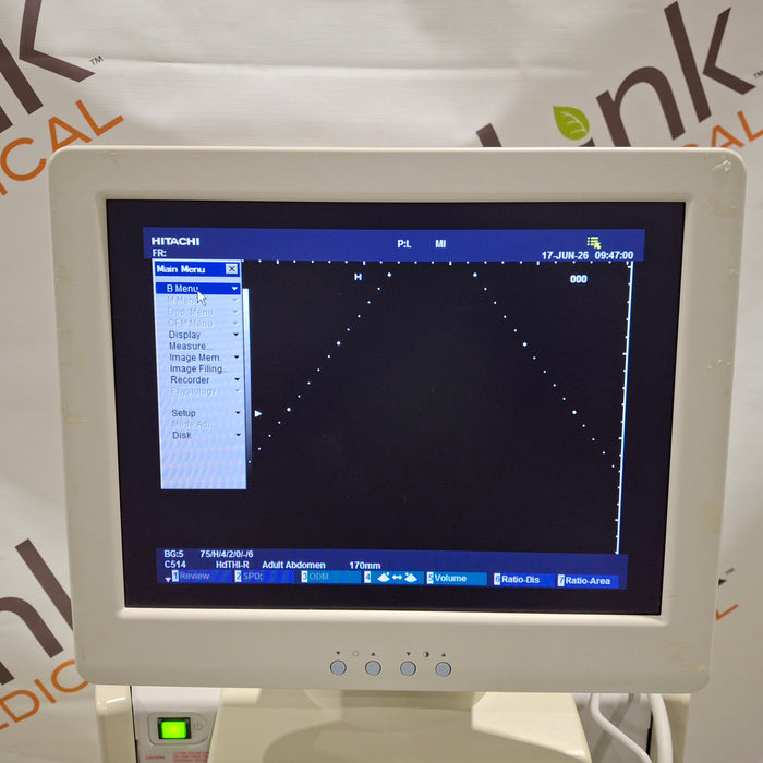 Hitachi Hi Vision 5500 Ultrasound