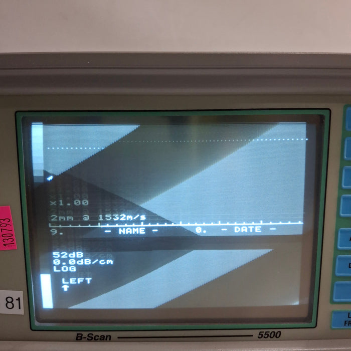 Sonomed Escalon B-Scan 5500 Ophthalmic Ultrasound