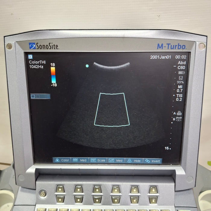 Sonosite M-Turbo Ultrasound