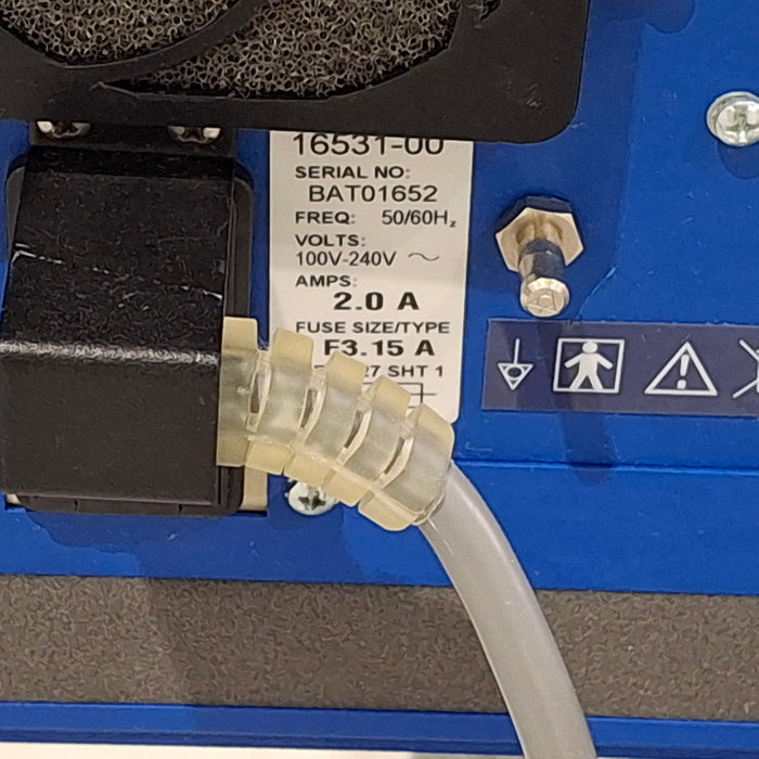 CareFusion Vela Ventilator
