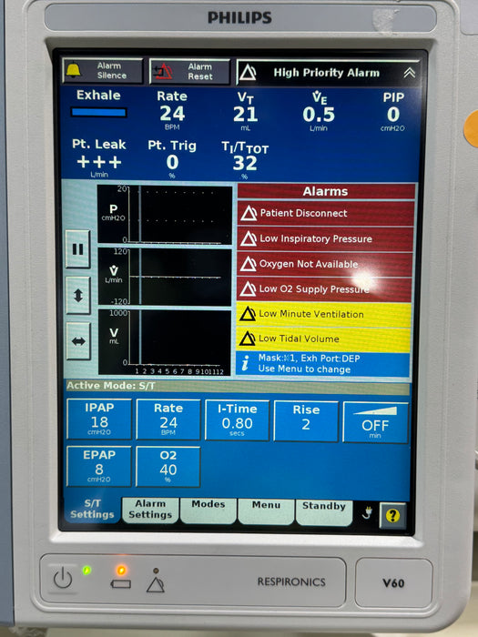 Philips Respironics V60 BiPAP Ventilator