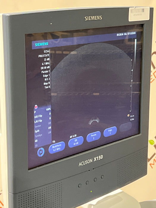 Siemens Acuson X150 Ultrasound