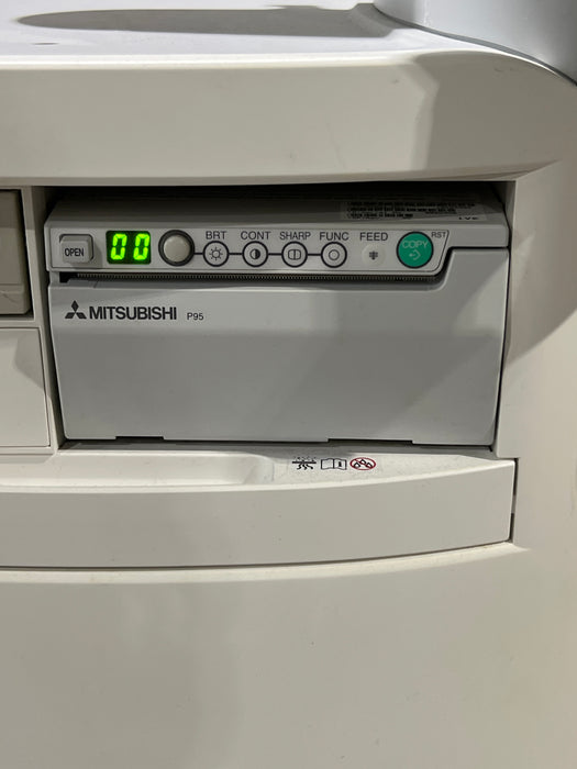 Siemens Acuson X150 Ultrasound