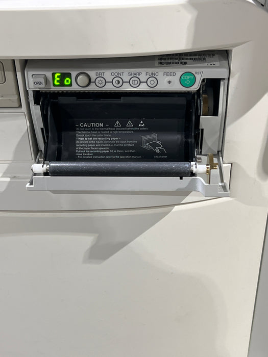 Siemens Acuson X150 Ultrasound