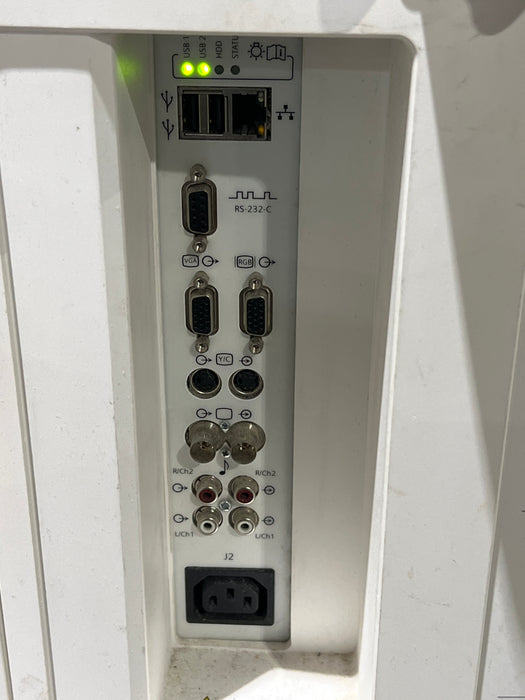 Siemens Acuson X150 Ultrasound