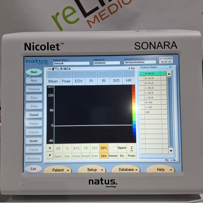 Nicolet Sonara Transcranial Doppler System