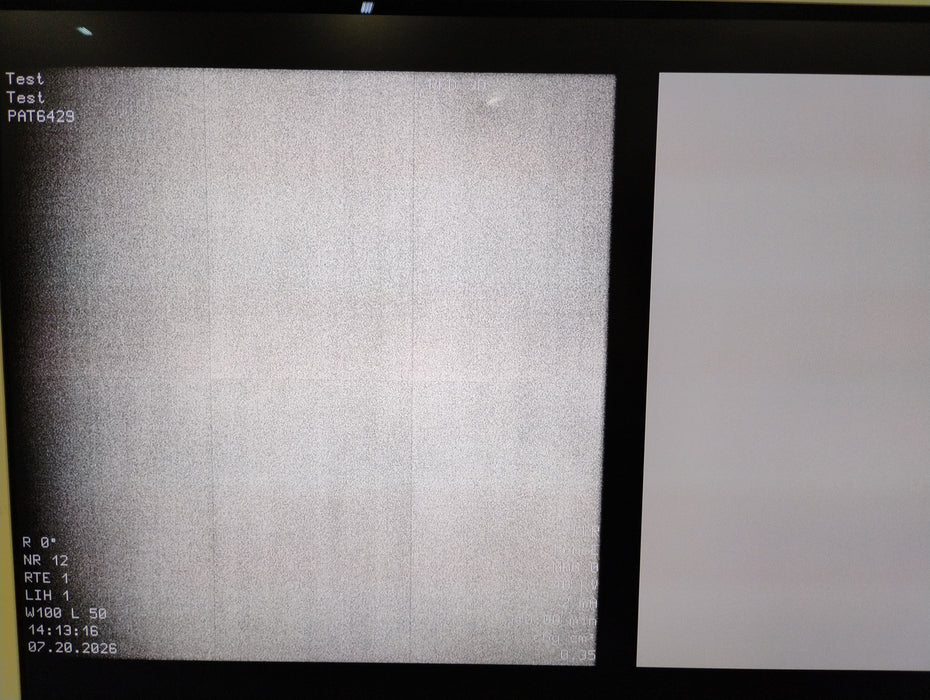 Ziehm Imaging Vision RFD 3D C-Arm