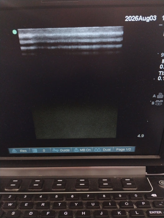 Sonosite Edge Ultrasound