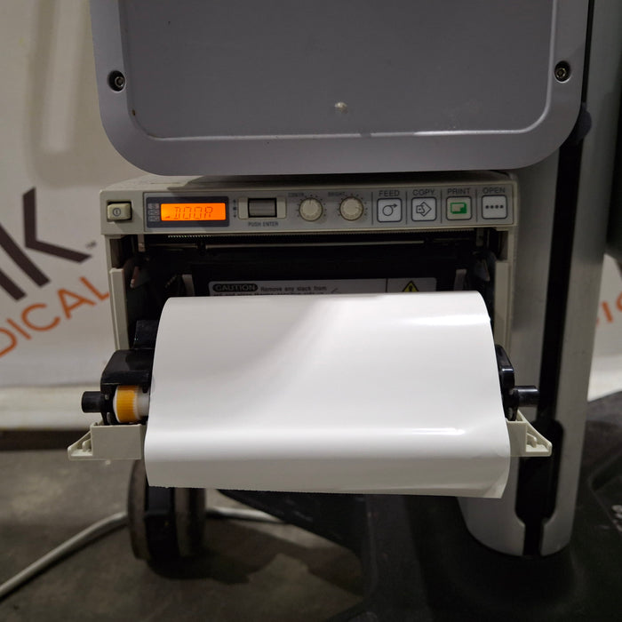 Sonosite S-Nerve Ultrasound