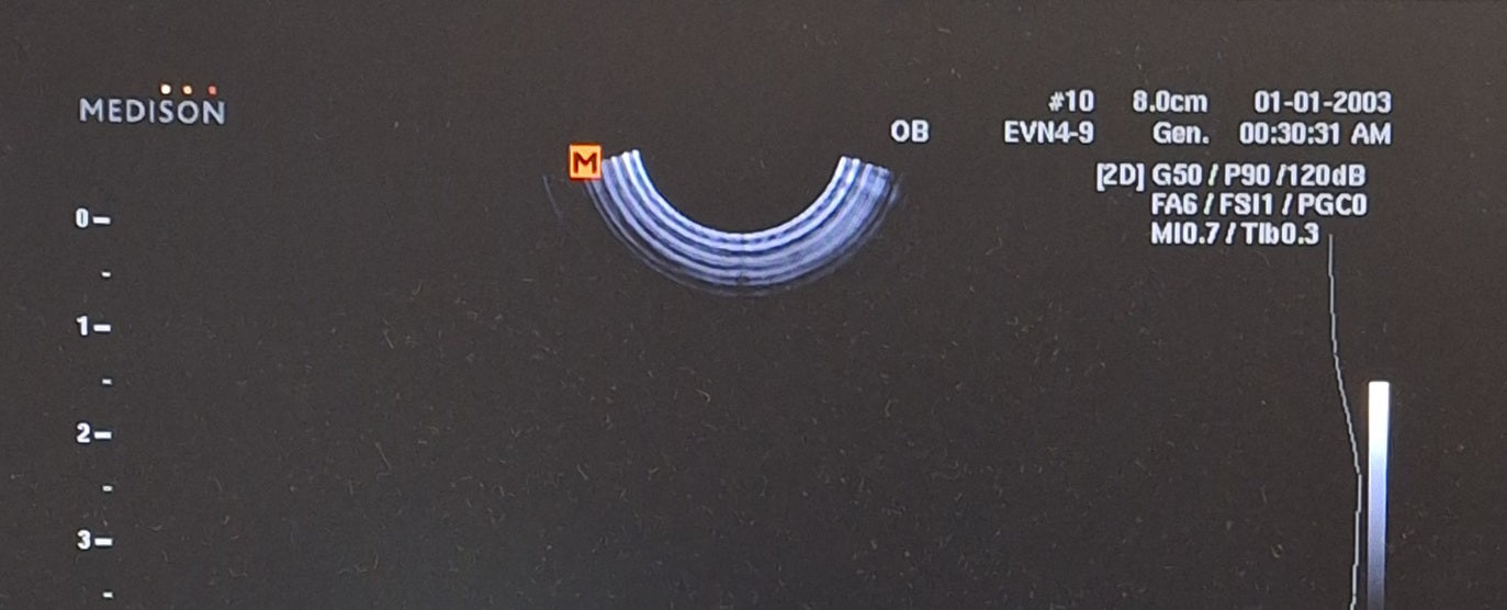 Samsung Samsung EVN4-9 Endocavity Transducer Ultrasound Probes reLink Online