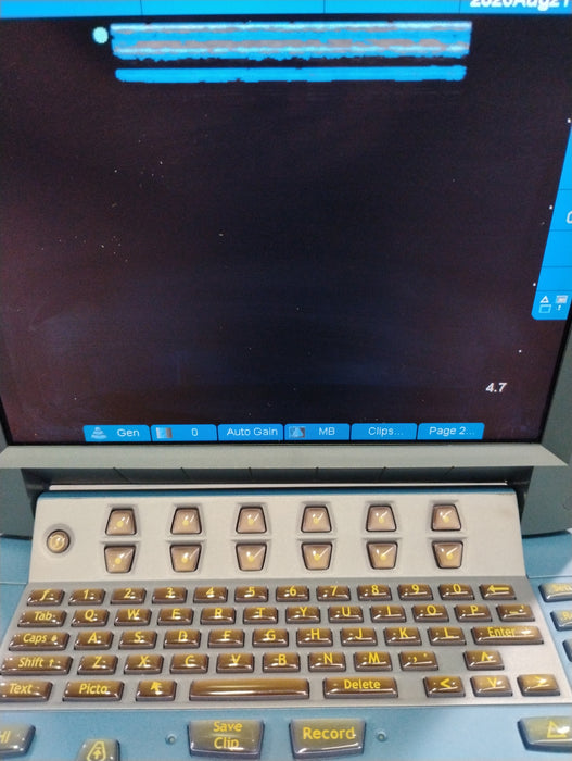 Sonosite Micromaxx Portable Ultrasound