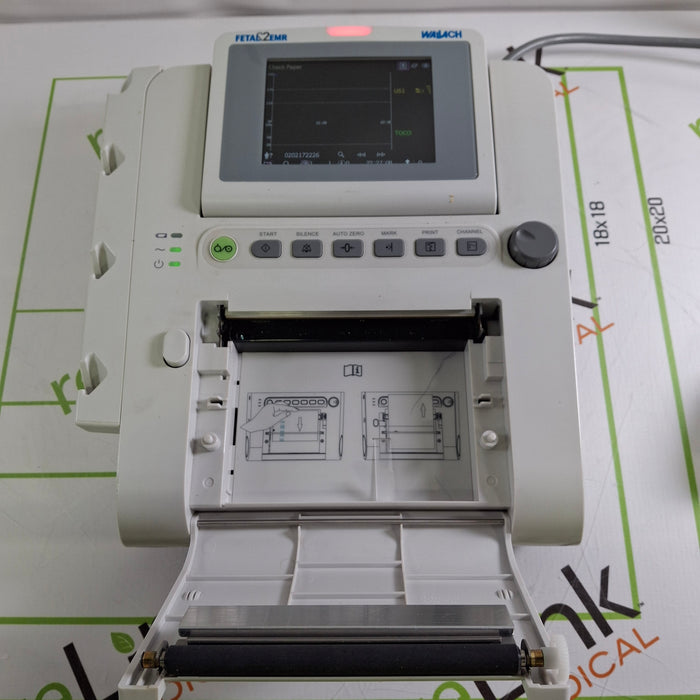 Wallach F3 Fetal Monitor