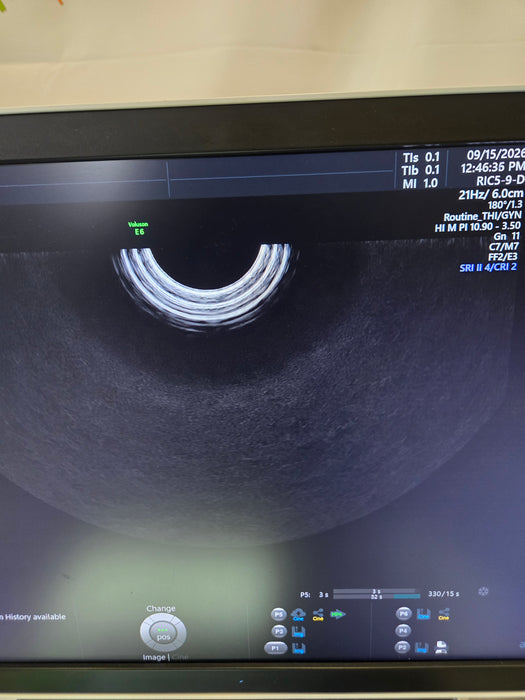 GE Healthcare Voluson E6 Ultrasound