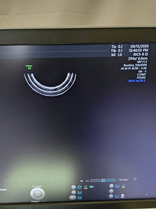 GE Healthcare Voluson E6 Ultrasound