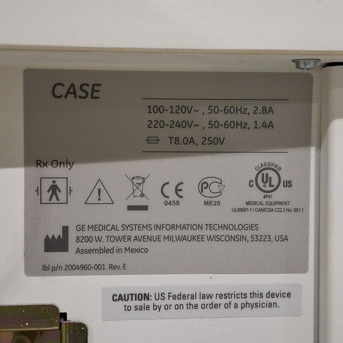 GE Healthcare Case P2 Stress Test Console