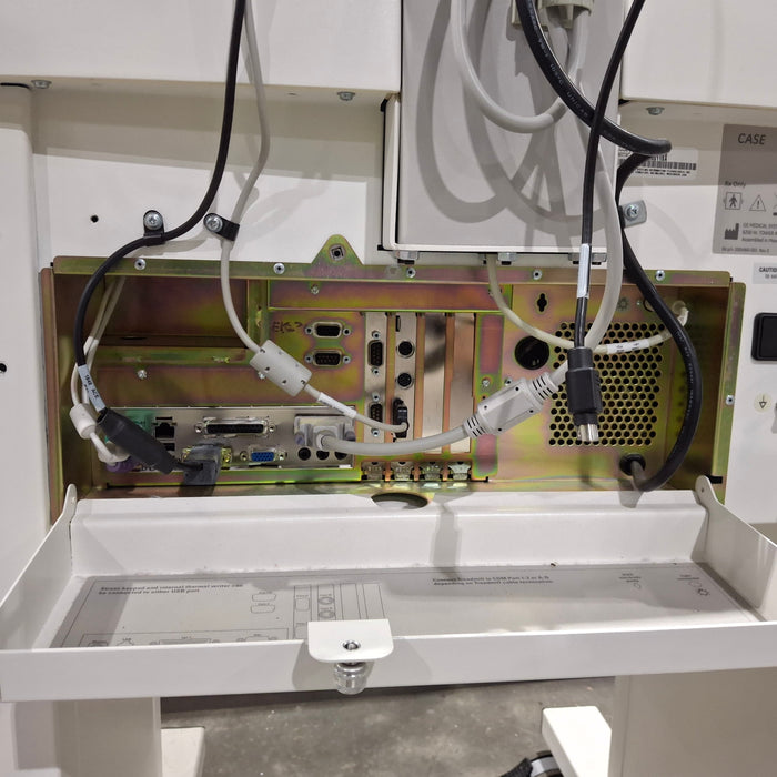 GE Healthcare Case P2 Stress Test Console